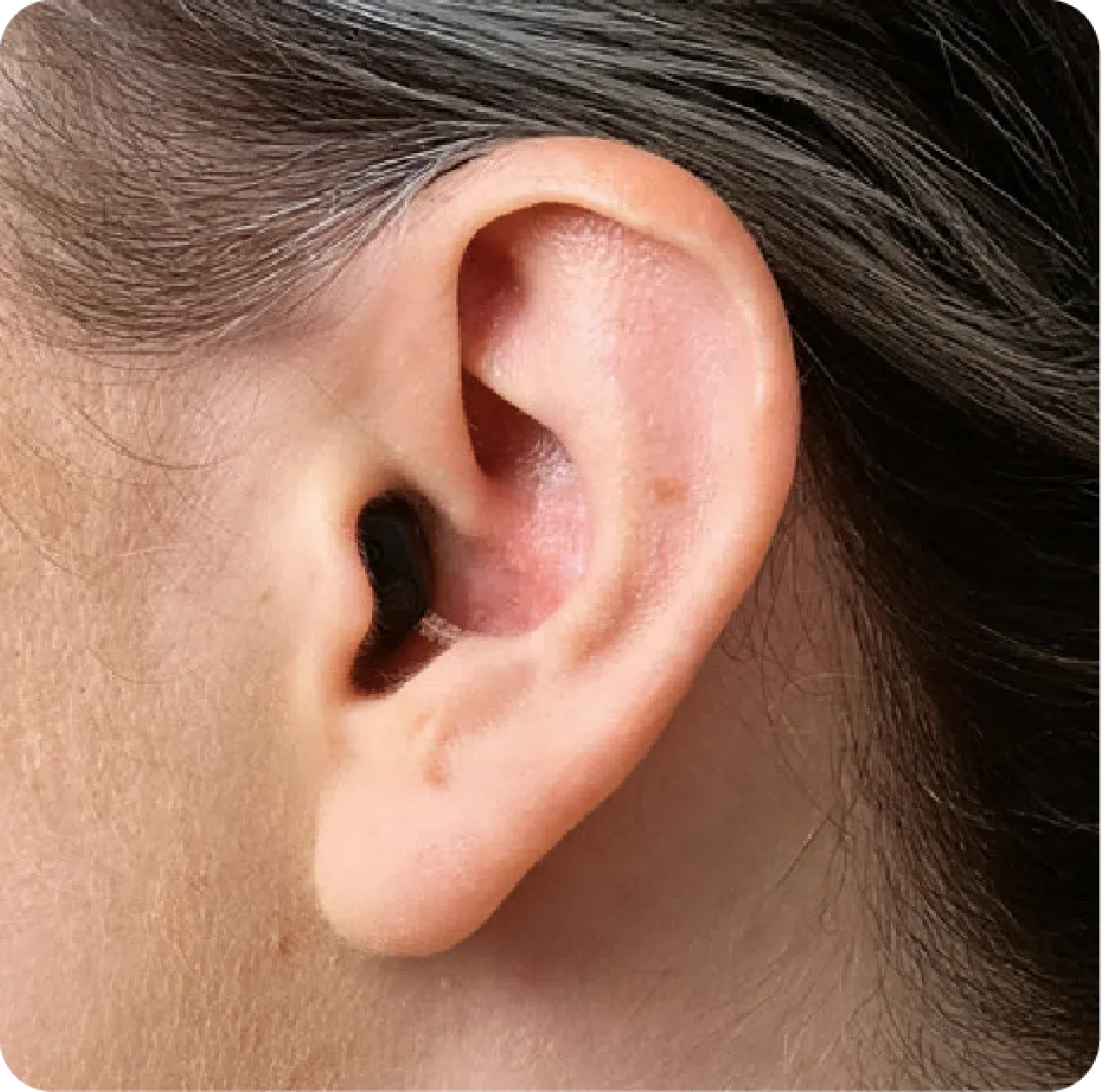 Oído con un audífono Philips HearLink NXT puesto, casi imperceptible